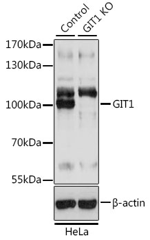Western blot - GIT1 Polyclonal Antibody 
