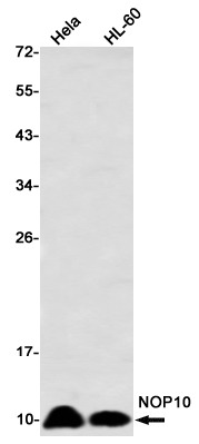 Western blot detection of NOP10 in Hela,HL-60 using NOP10 Rabbit mAb(1:1000 diluted)