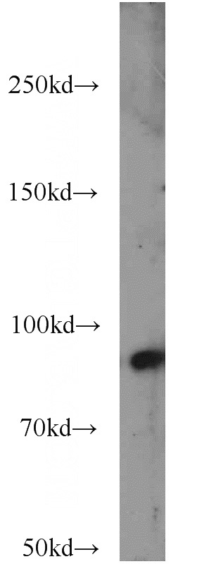 L02 cells were subjected to SDS PAGE followed by western blot with Catalog No:111587(ICAM-1 antibody) at dilution of 1:800