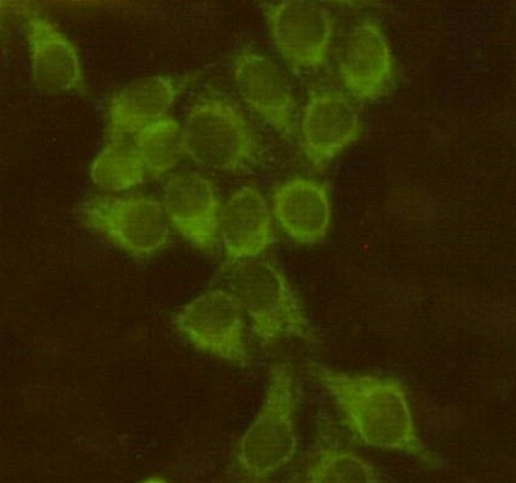 Immunocytochemistry staining of HeLa cells using Bid mouse mAb (dilution 1:100).