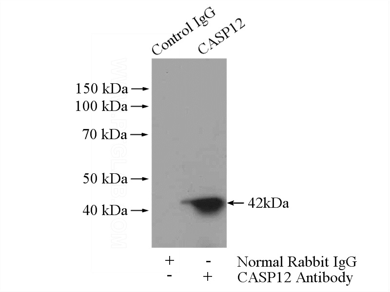 IP Result of anti-Caspase 12 (IP:Catalog No:108872, 4ug; Detection:Catalog No:108872 1:1000) with HEK-293 cells lysate 2000ug.