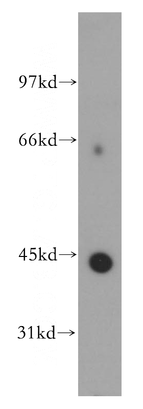 human brain tissue were subjected to SDS PAGE followed by western blot with Catalog No:112068(KCNJ13 antibody) at dilution of 1:300