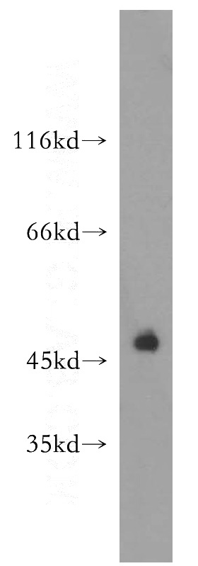 HEK-293 cells were subjected to SDS PAGE followed by western blot with Catalog No:113761(PD-1 antibody) at dilution of 1:500