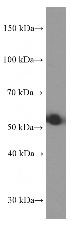 pig lung tissue were subjected to SDS PAGE followed by western blot with (SRPX2 Antibody) at dilution of 1:1000