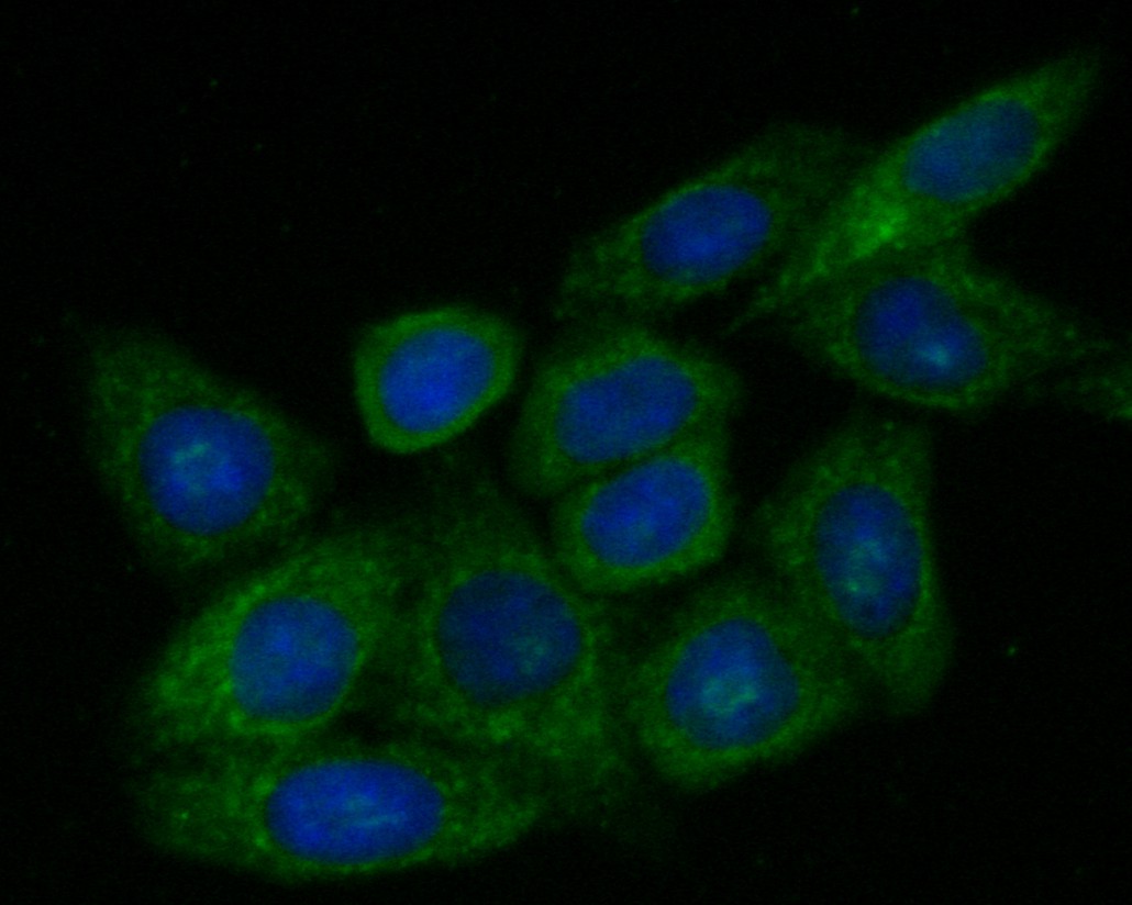 Fig3: ICC staining of ZAC in SiHa cells (green). Formalin fixed cells were permeabilized with 0.1% Triton X-100 in TBS for 10 minutes at room temperature and blocked with 1% Blocker BSA for 15 minutes at room temperature. Cells were probed with the primary antibody ( 1/200) for 1 hour at room temperature, washed with PBS. Alexa Fluor®488 Goat anti-Rabbit IgG was used as the secondary antibody at 1/1,000 dilution. The nuclear counter stain is DAPI (blue).
