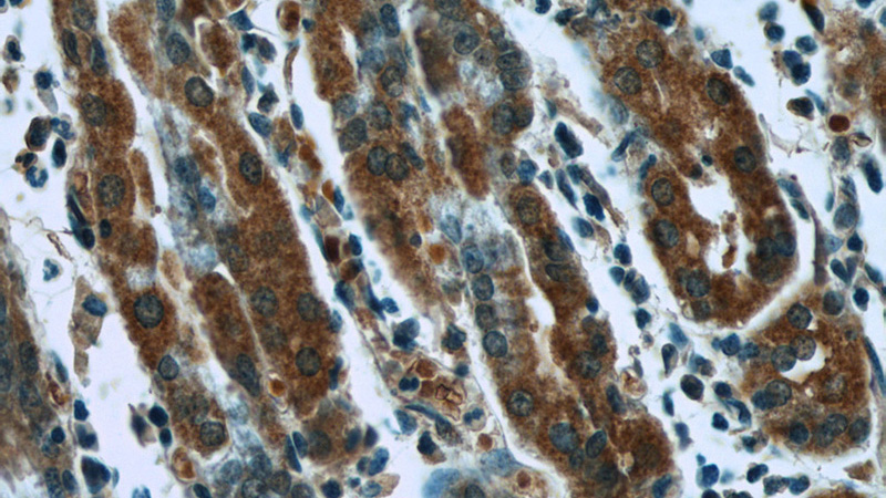 Immunohistochemistry of paraffin-embedded human stomach tissue slide using Catalog No:107234(KRT8 Antibody) at dilution of 1:50 (under 40x lens)