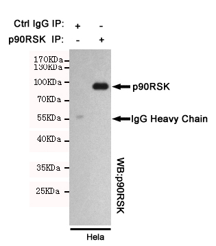 Immunoprecipitation analysis of Hela cell lysates using p90RSK mouse mAb.