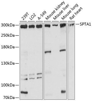 Western blot - SPTA1 Polyclonal Antibody 