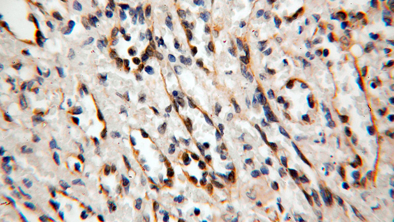 Immunohistochemical of paraffin-embedded human spleen using Catalog No:107814(ABHD2 antibody) at dilution of 1:100 (under 40x lens)