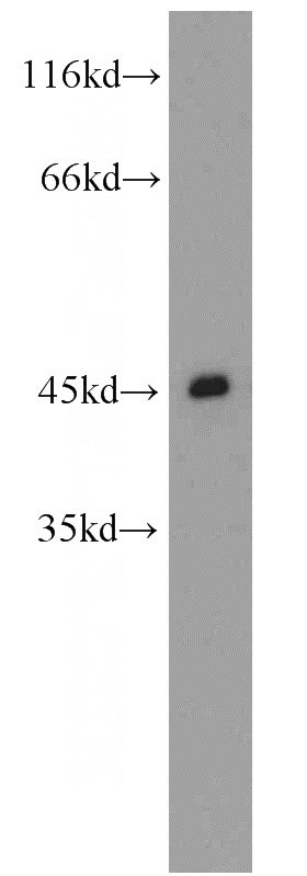 HeLa cells were subjected to SDS PAGE followed by western blot with Catalog No:109077(CCR5 antibody) at dilution of 1:800