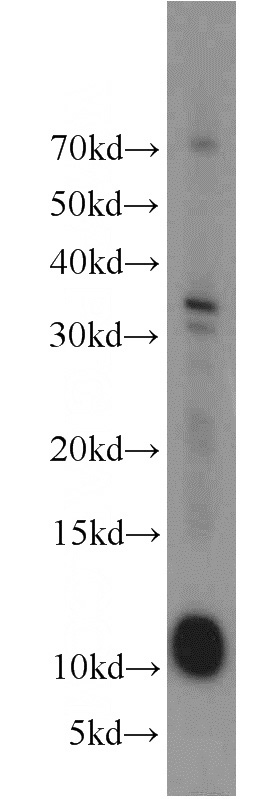 human heart tissue were subjected to SDS PAGE followed by western blot with Catalog No:112269(LAMA4 antibody) at dilution of 1:1000