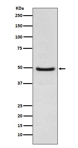 Western blot analysis of LXR alpha expression in Jurkat cell lysate.