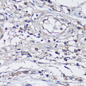 Immunohistochemistry - NLRC4 Polyclonal Antibody 