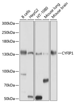 Western blot - CYFIP1 Polyclonal Antibody 