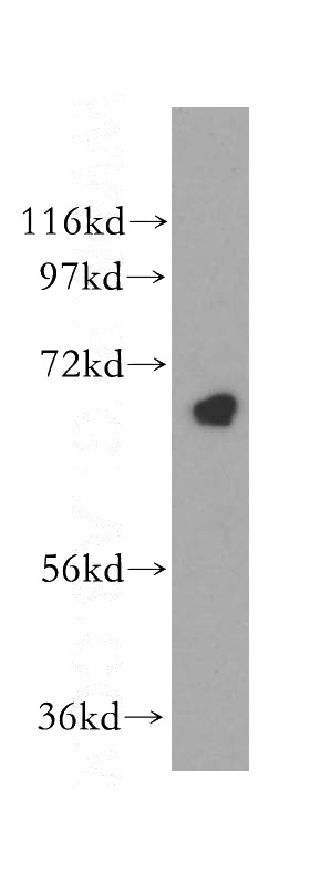 Jurkat cells were subjected to SDS PAGE followed by western blot with Catalog No:109184(CEP68 antibody) at dilution of 1:400