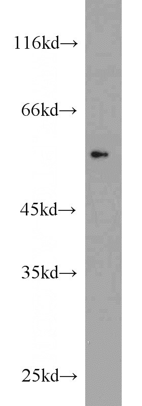 Recombinant protein were subjected to SDS PAGE followed by western blot with Catalog No:117342(V5-tag antibody) at dilution of 1:32000