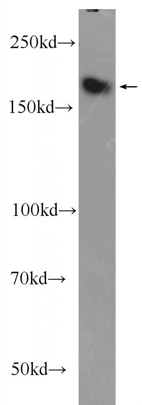 PC-3 cells were subjected to SDS PAGE followed by western blot with Catalog No:116934(ZCCHC6 Antibody) at dilution of 1:1000