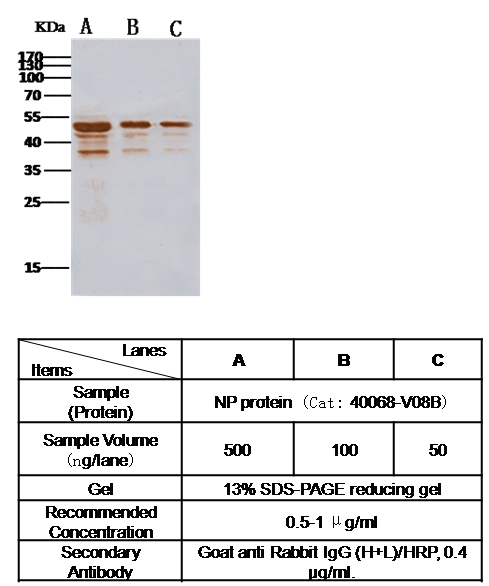 Anti-Novel coronavirus (HCoV-EMC/2012) Nucleocapsid Protein Antibody (N-terminal), Rabbit PAb, Antigen Affinity Purified, Western blot