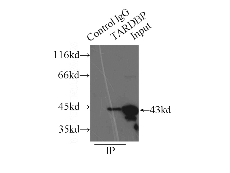 IP Result of anti-TARDBP (IP:Catalog No:115926, 3ug; Detection:Catalog No:115926 1:1000) with HeLa cells lysate 3000ug.