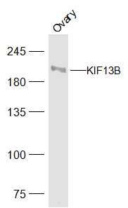 Fig1: Sample:; Ovary (Rat) Lysate at 40 ug; Primary: Anti-KIF13B at 1/500 dilution; Secondary: IRDye800CW Goat Anti-Rabbit IgG at 1/20000 dilution; Predicted band size: 203 kD; Observed band size: 203 kD