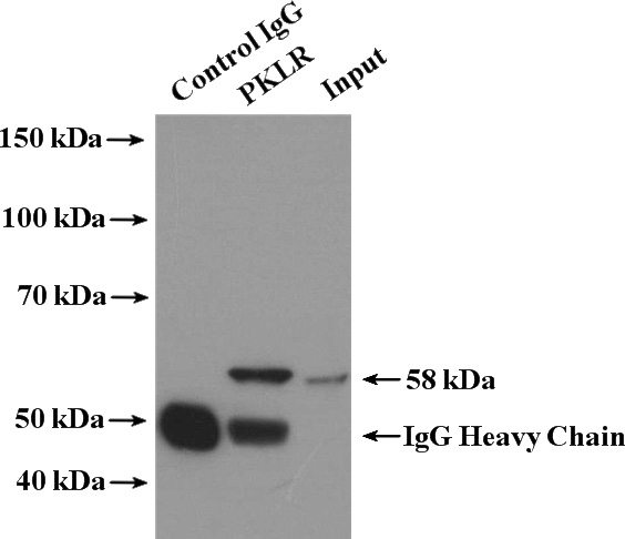 IP Result of anti-PKLR (IP:Catalog No:113857, 4ug; Detection:Catalog No:113857 1:500) with K-562 cells lysate 3200ug.