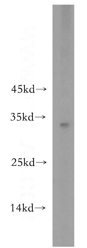 mouse brain tissue were subjected to SDS PAGE followed by western blot with Catalog No:114851(RSPO2 antibody) at dilution of 1:3000