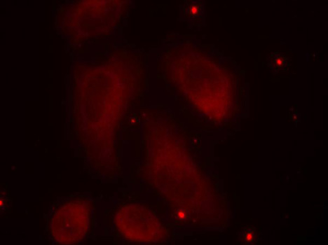 Immunofluorescence - Phospho-LIMK1-T508 pAb 