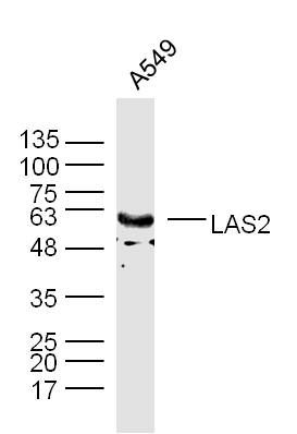 Fig1: Sample: A549 Cell (Human) Lysate at 40 ug; Primary: Anti-LAS2 at 1/300 dilution; Secondary: IRDye800CW Goat Anti-Rabbit IgG at 1/20000 dilution; Predicted band size: 39/60 kD; Observed band size: 60 kD