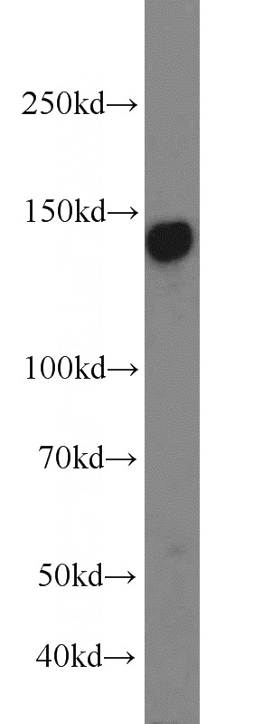HepG2 cells were subjected to SDS PAGE followed by western blot with Catalog No:117080(AXL antibody) at dilution of 1:1500
