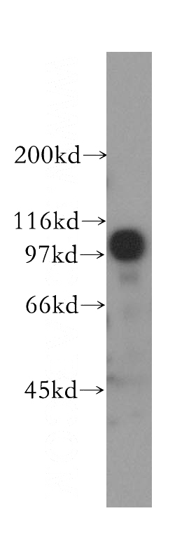HeLa cells were subjected to SDS PAGE followed by western blot with Catalog No:109820(DDX20 antibody) at dilution of 1:500