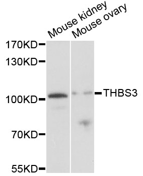 Western blot - THBS3 Polyclonal Antibody 