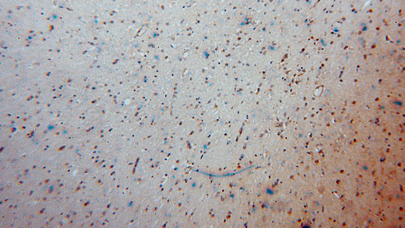Immunohistochemical of paraffin-embedded human brain using Catalog No:109184(CEP68 antibody) at dilution of 1:100 (under 10x lens)