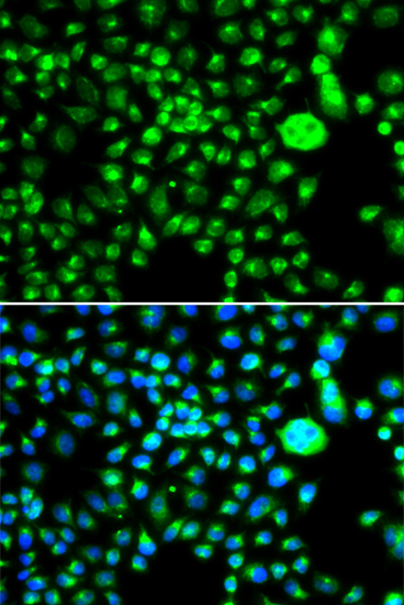 Immunofluorescence - SMCHD1 Polyclonal Antibody 