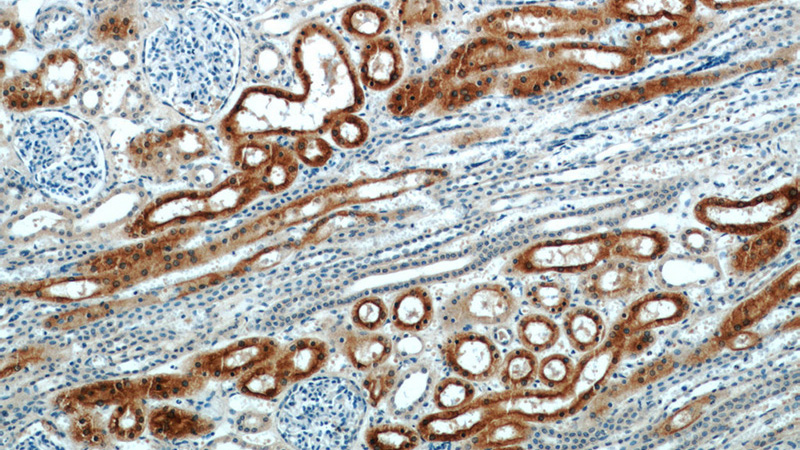 Immunohistochemical of paraffin-embedded human kidney using Catalog No:109703(CYP4A11 antibody) at dilution of 1:50 (under 10x lens)