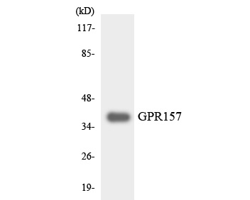 Fig1:; Western blot analysis of GPR157 on RAW264.7 cell lysates. Proteins were transferred to a PVDF membrane and blocked with 5% BSA in PBS for 1 hour at room temperature. The primary antibody ( 1/500) was used in 5% BSA at room temperature for 2 hours. Goat Anti-Rabbit IgG - HRP Secondary Antibody (HA1001) at 1:5,000 dilution was used for 1 hour at room temperature.