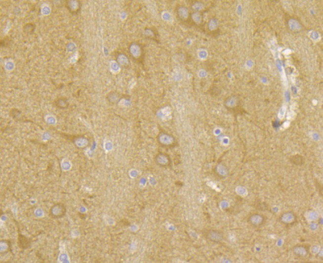 Fig3: Immunohistochemical analysis of paraffin-embedded rat brain tissue using anti-RYR3 antibody. The section was pre-treated using heat mediated antigen retrieval with Tris-EDTA buffer (pH 8.0-8.4) for 20 minutes.The tissues were blocked in 5% BSA for 30 minutes at room temperature, washed with ddH2O and PBS, and then probed with the antibody at 1/50 dilution, for 30 minutes at room temperature and detected using an HRP conjugated compact polymer system. DAB was used as the chrogen. Counter stained with hematoxylin and mounted with DPX.