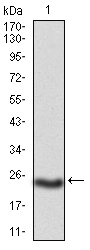 Fig1: Western blot analysis of PKHD1 on mouse PKHD1 recombinant protein using anti-PKHD1 antibody at 1/1,000 dilution.