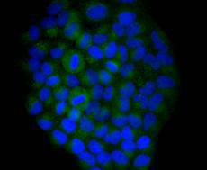 Fig2: Immunocytochemical staining of Hela cells using anti-YB1 rabbit polyclonal antibody.
