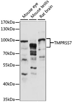 Western blot - TMPRSS7 Polyclonal Antibody 