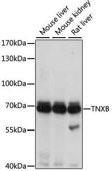 Western blot - TNXB Polyclonal Antibody 