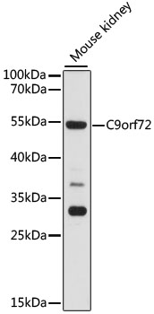 Western blot - C9orf72 Polyclonal Antibody 
