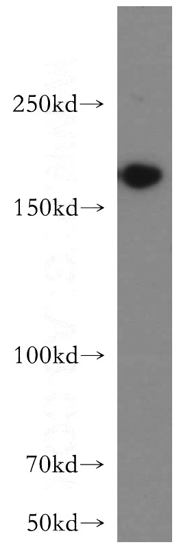 HeLa cells were subjected to SDS PAGE followed by western blot with Catalog No:110042(DocK1-Specific antibody) at dilution of 1:400