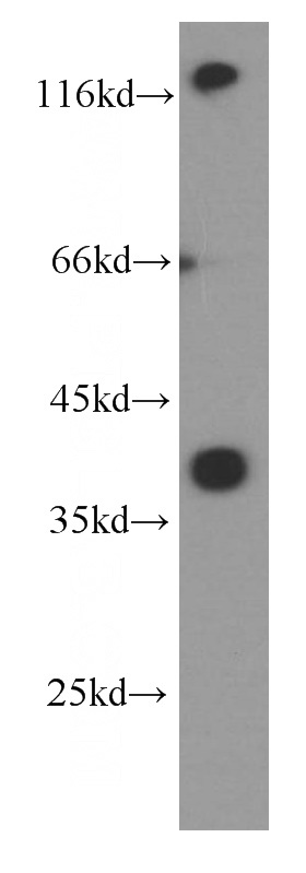 fetal human brain tissue were subjected to SDS PAGE followed by western blot with Catalog No:107235(DAO Antibody) at dilution of 1:1000