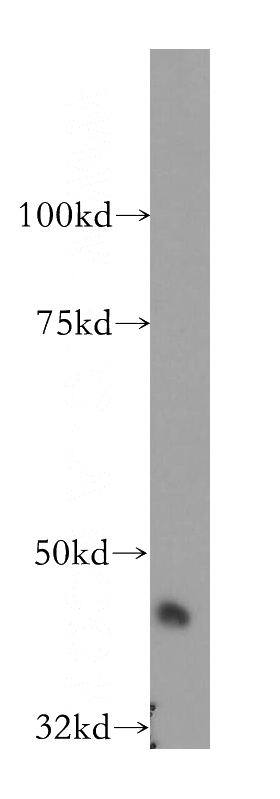 mouse pancreas tissue were subjected to SDS PAGE followed by western blot with Catalog No:115210(SERPINI2 antibody) at dilution of 1:400