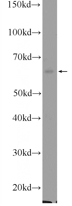 HEK-293 cells were subjected to SDS PAGE followed by western blot with Catalog No:109433(CNOT2 Antibody) at dilution of 1:300