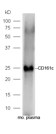 Fig1: Sample: Plasma (Mouse) Lysate at 40 ug; Primary: Anti-CD161c at 1/300 dilution; Secondary: HRP conjugated Goat-Anti-rabbit IgG (bs-0295G-HRP) at 1/5000 dilution; Predicted band size: 25 kD; Observed band size: 25 kD