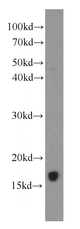 Jurkat cells were subjected to SDS PAGE followed by western blot with Catalog No:107401(IL4 antibody) at dilution of 1:1000
