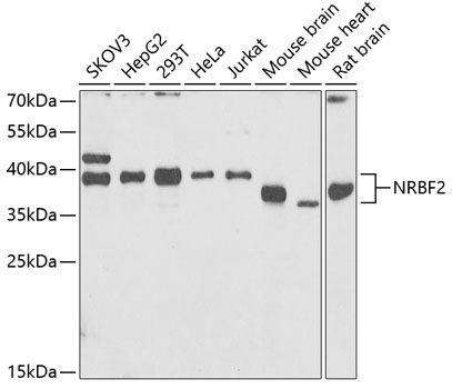 Western blot - NRBF2 Polyclonal Antibody 