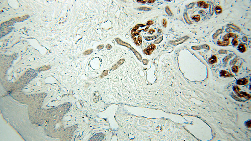 Immunohistochemical of paraffin-embedded human skin using Catalog No:110900(GCDFP-15, PIP antibody) at dilution of 1:50 (under 10x lens)