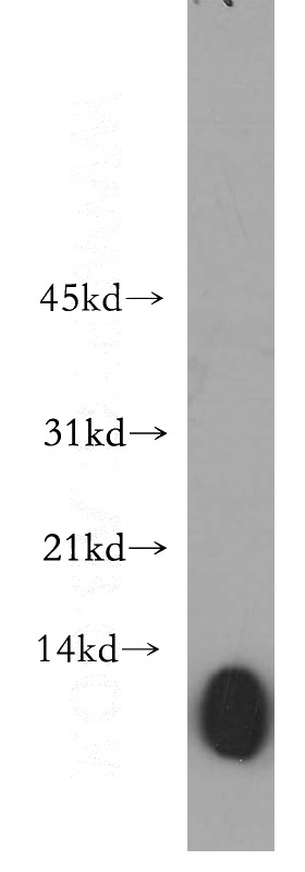 human lung tissue were subjected to SDS PAGE followed by western blot with Catalog No:116708(VAMP5 antibody) at dilution of 1:400